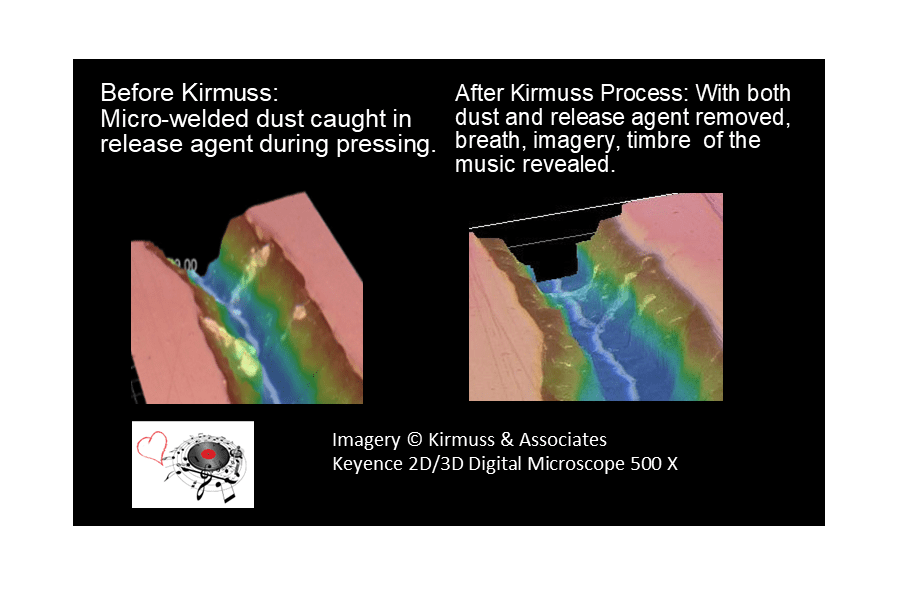 Kirmuss release before and after